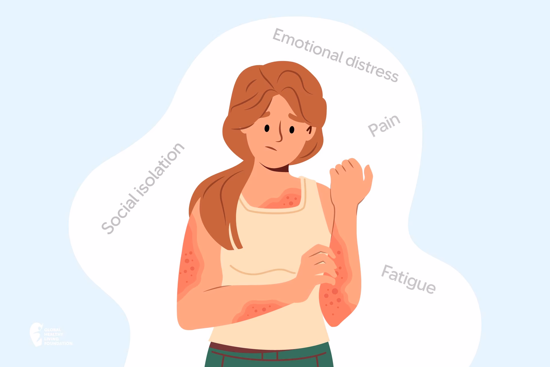 Is psoriatic fatigue a sign of inflammatory activity?