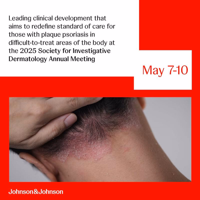 Can icotrokinra change psoriasis treatment expectations?