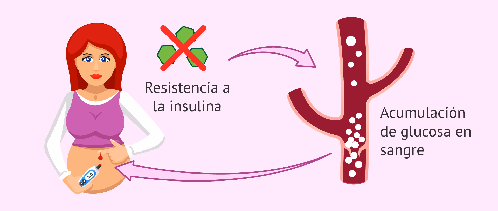 ¿Cuáles son los tipos de diabetes?