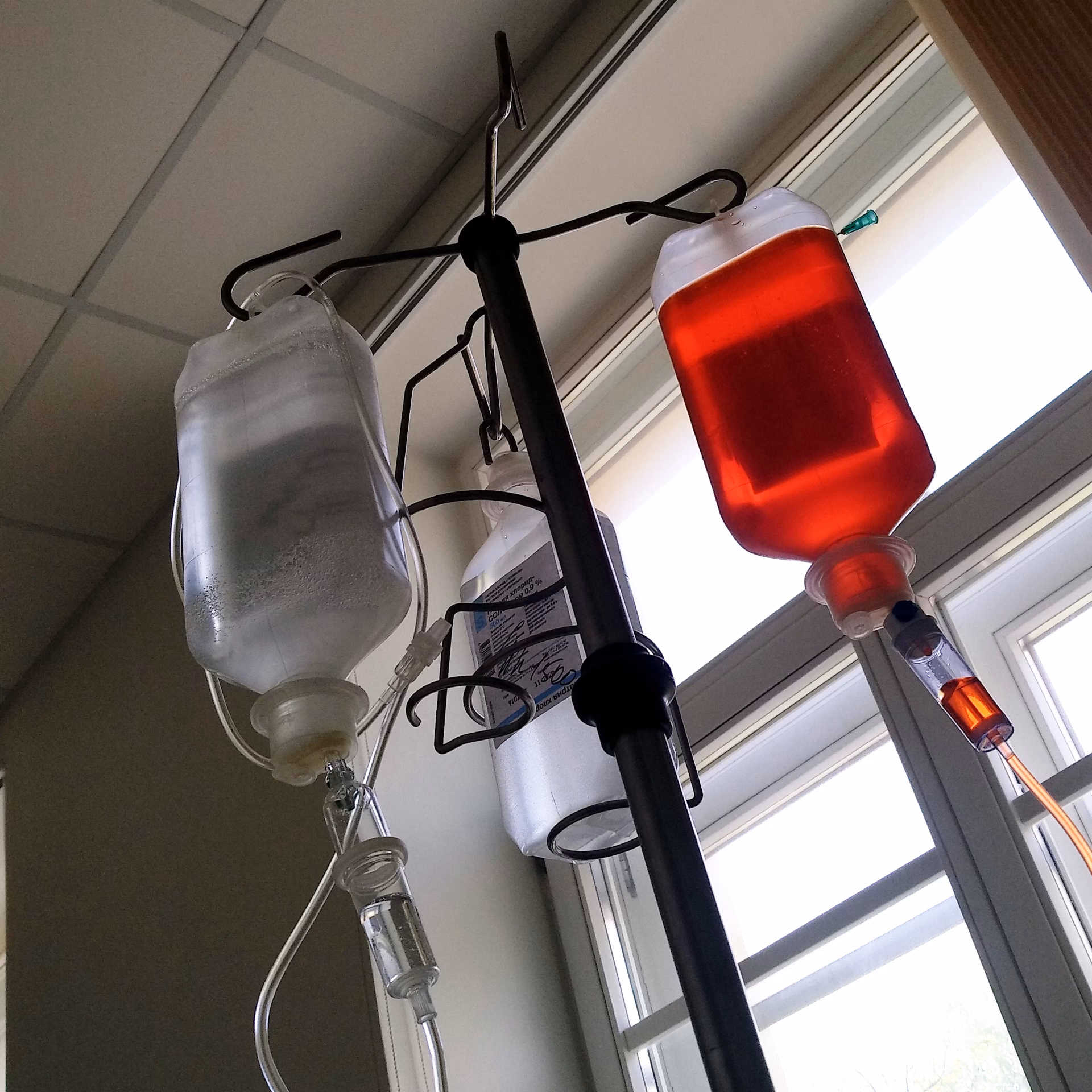 What is the difference between Chop and R-CHOP chemotherapy?