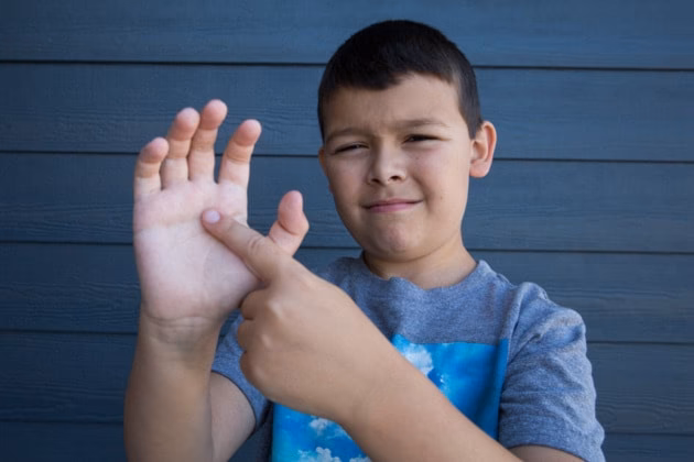 Is rabies a serious disease?