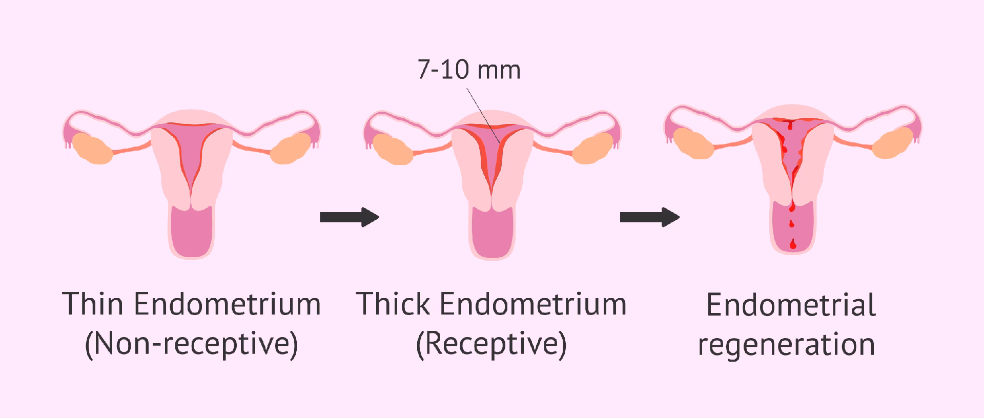 What is a receptive person?