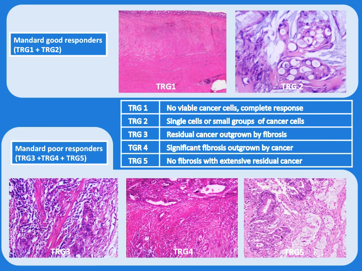 What are regression models in medical research?