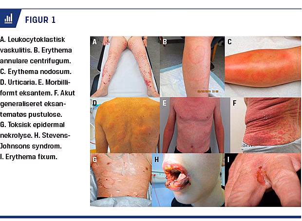 Are allergic diseases associated with incident rheumatoid arthritis (RA)?