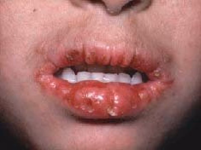 Is riboflavin a vitamin B2?