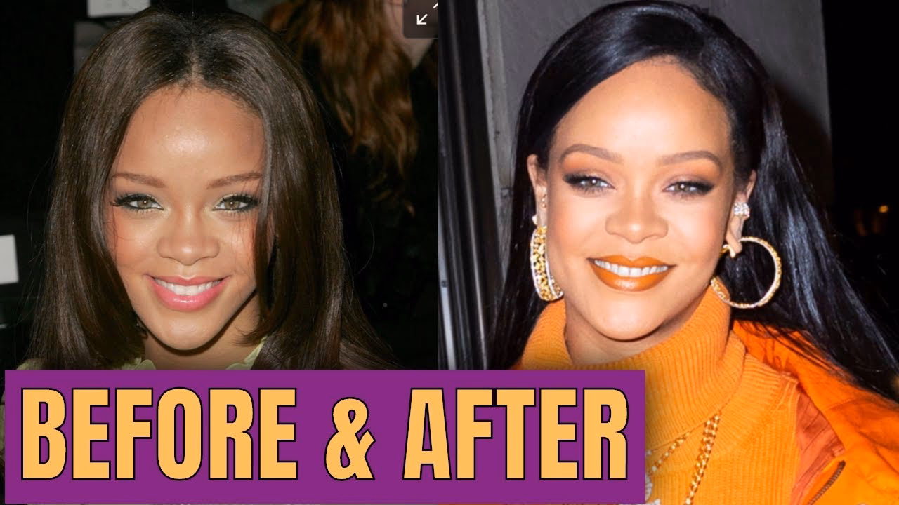 Did Rihanna get a facelift?