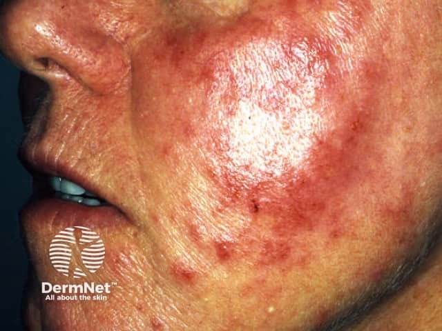 Is rosin toxic on its own?