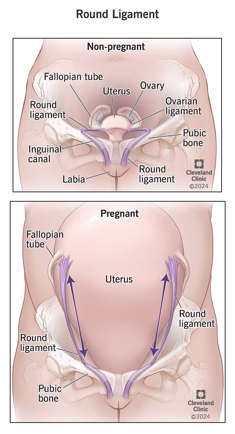 What does round ligament pain feel like during pregnancy?