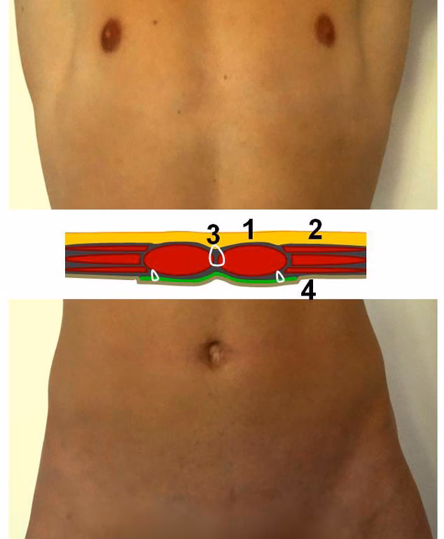 Wie pflege ich meine Wunden nach einer Operation?