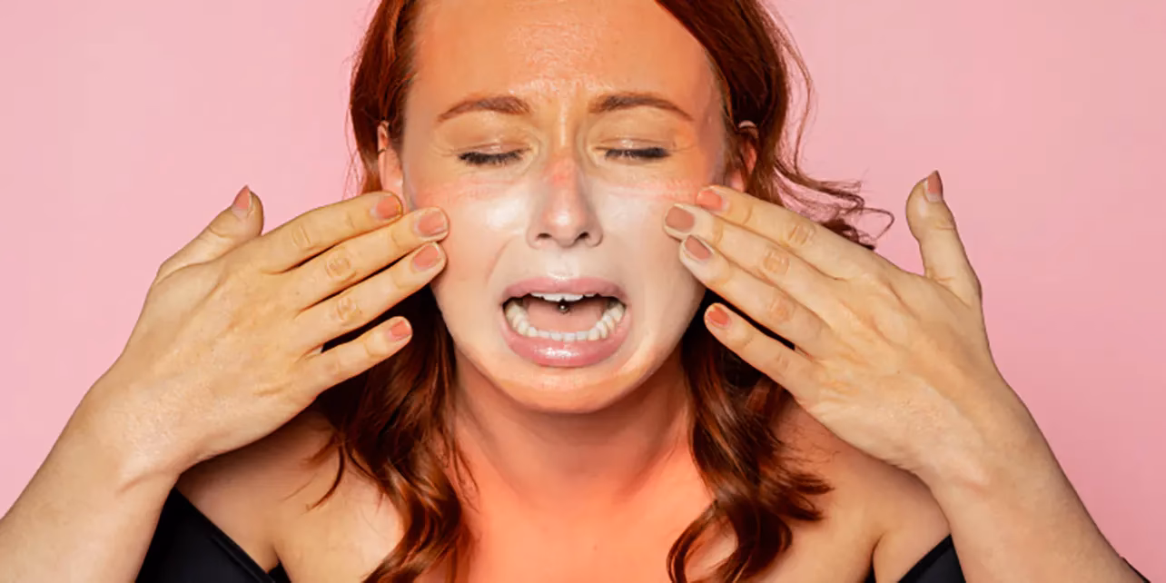 Can a salicylate allergy cause hives?