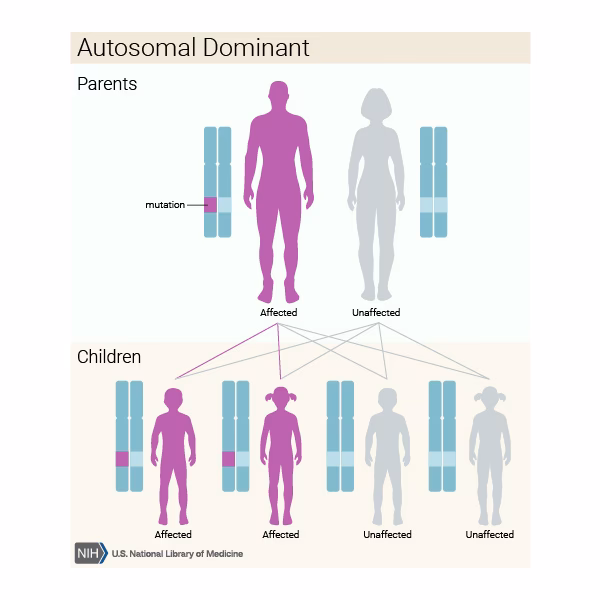 What chromosome 22q11.21 is a schizophrenic condition?