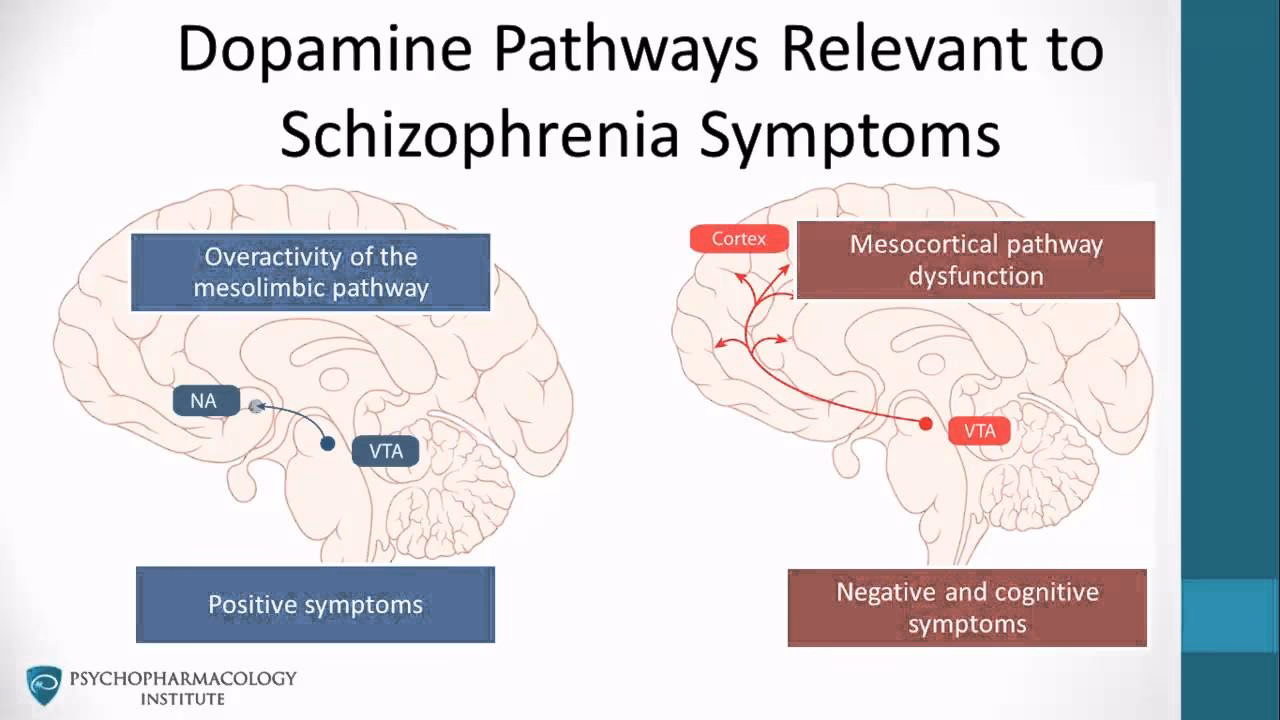 Does dopamine play a key role in schizophrenia?
