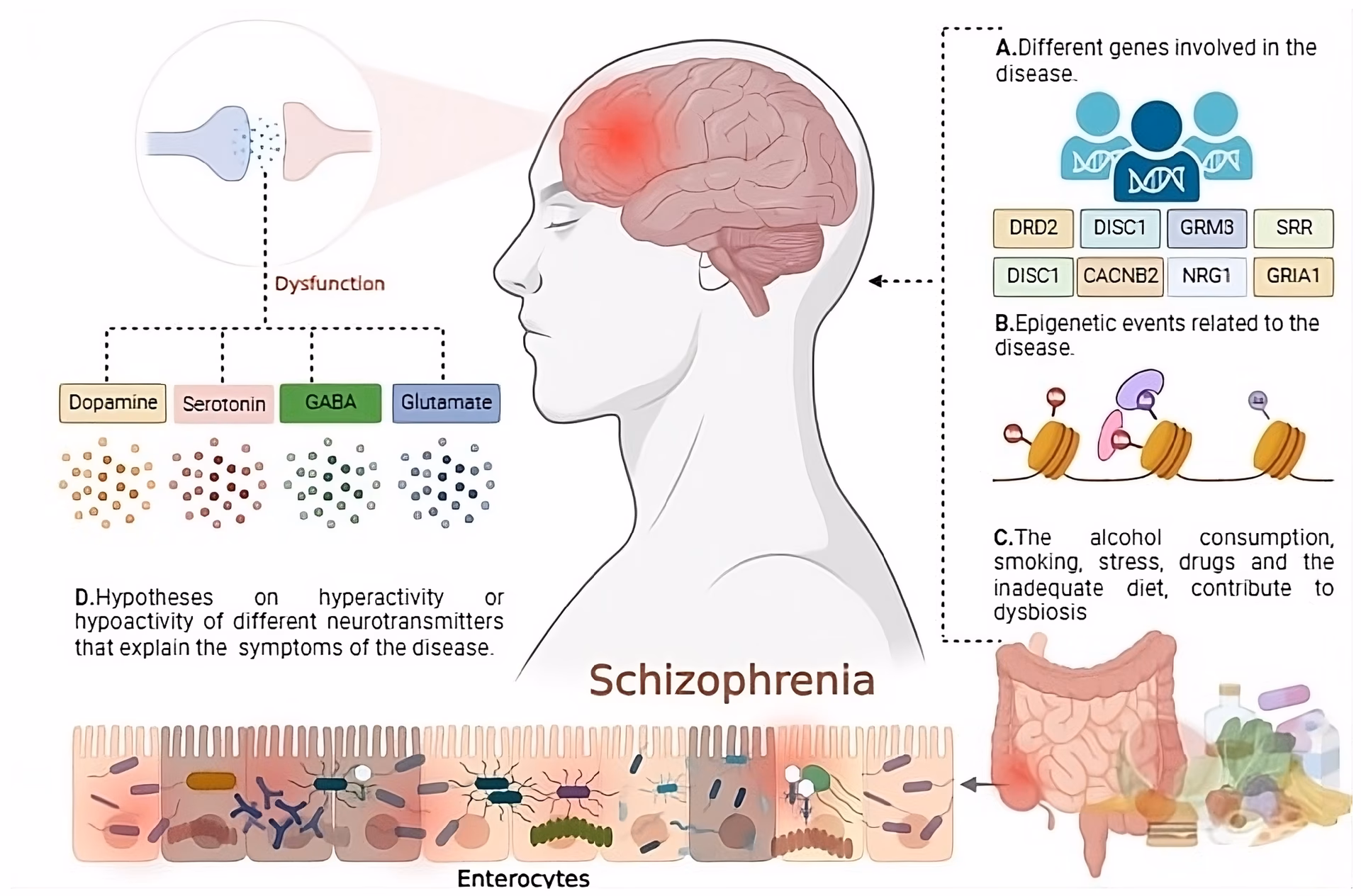 Is schizophrenia a psychiatric disorder?