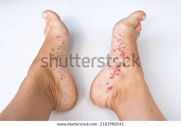 What are roofing shingles?