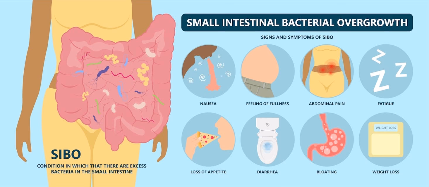 Can SIBO cause allergies?