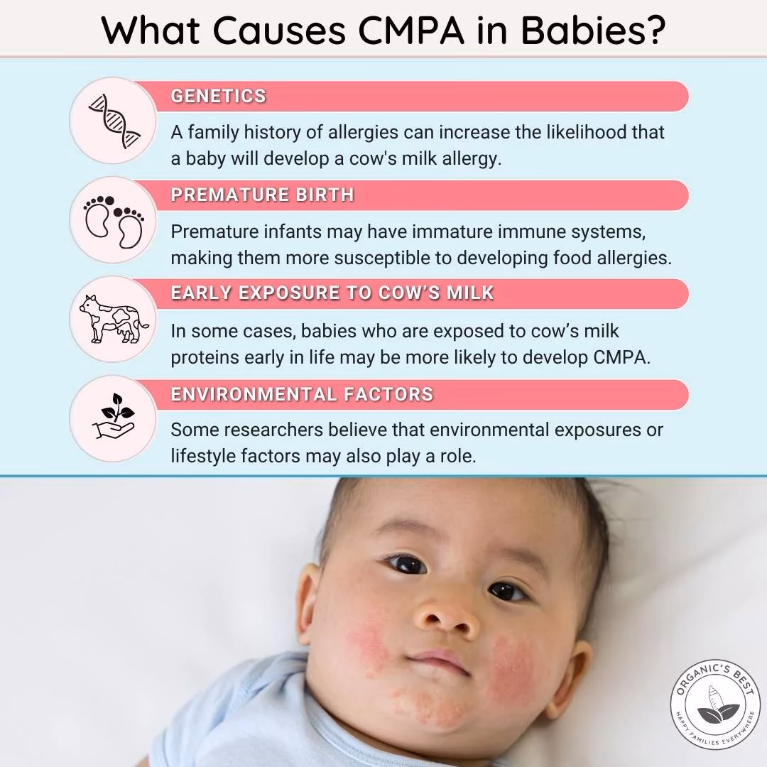 Can a baby have a milk allergy?