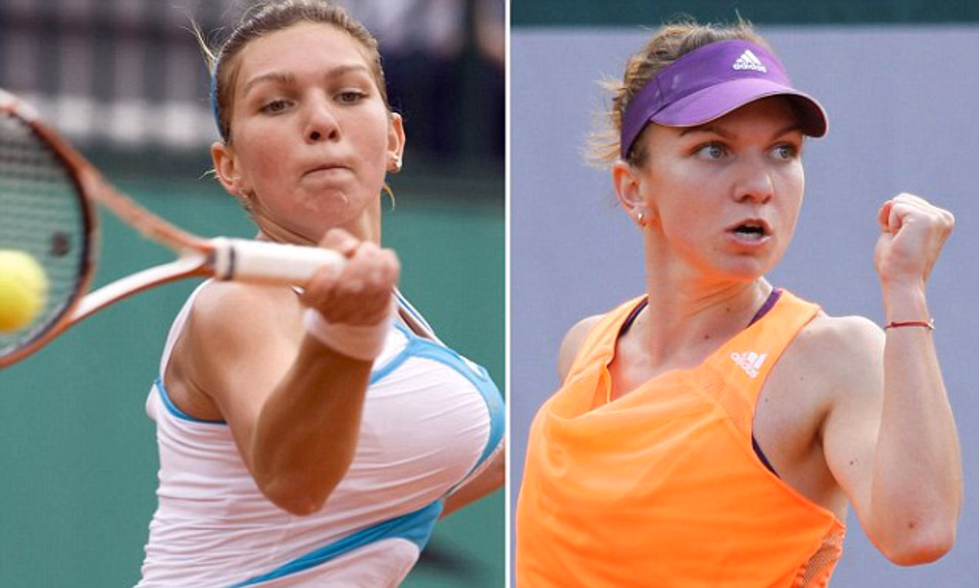 Did Simona Halep have breast reduction surgery to win a grand slam?