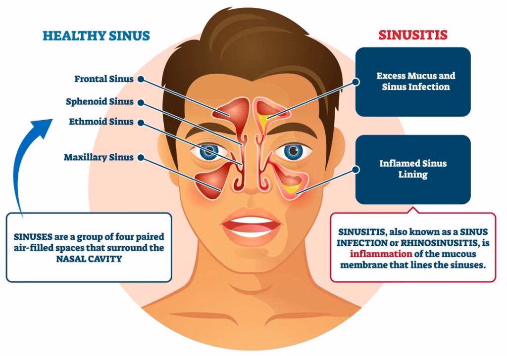Can a hot or cold pack help with sinus pain?