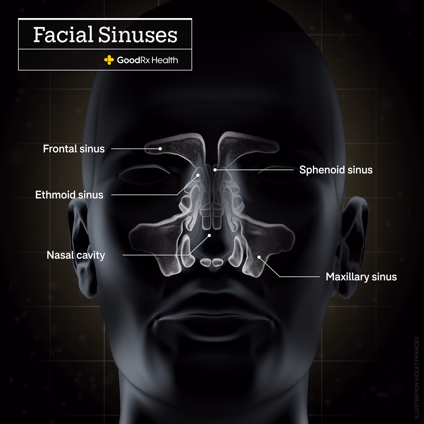 Can zepbound (tirzepatide) cause headaches?