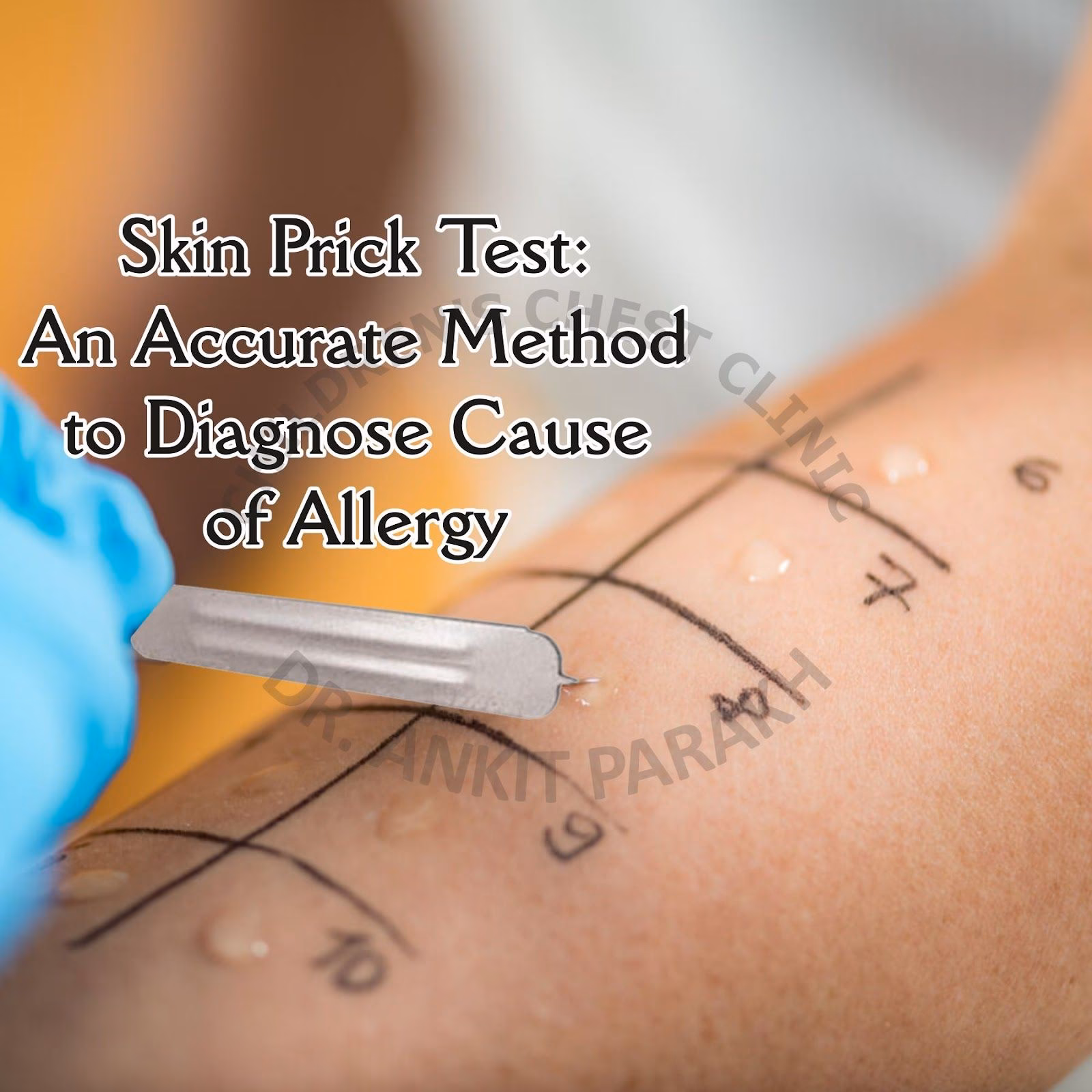 Do prick tests predict allergic reactions?