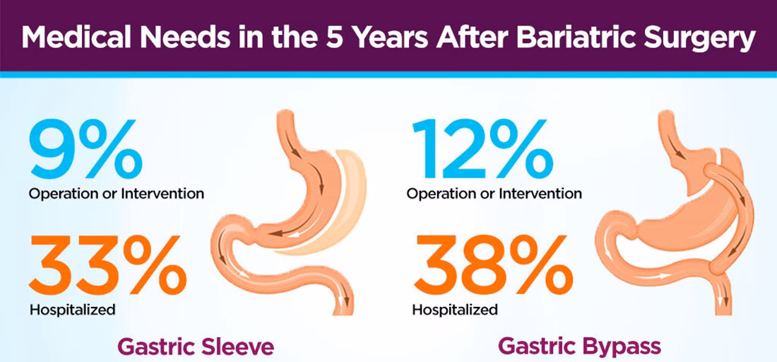 What are the risks of gastric sleeve surgery?