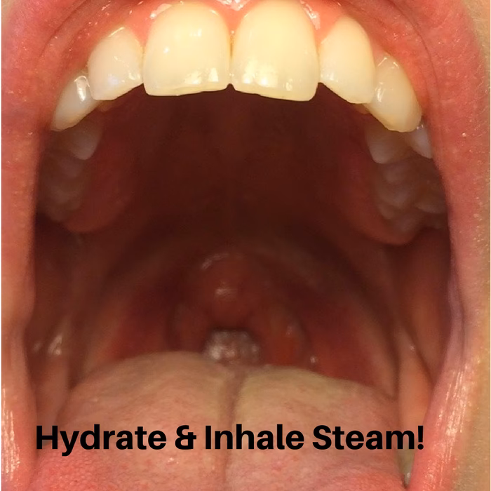 What if I have a sore while singing?