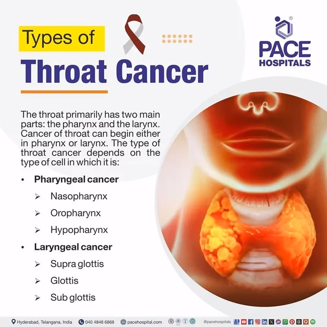 How is throat cancer treated?