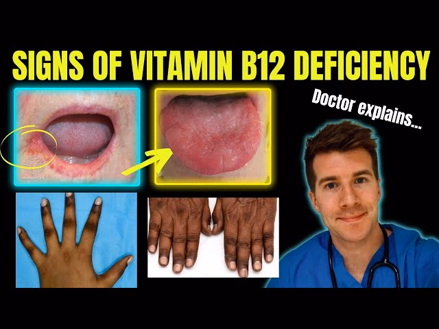 Can B12 deficiency cause throat problems?