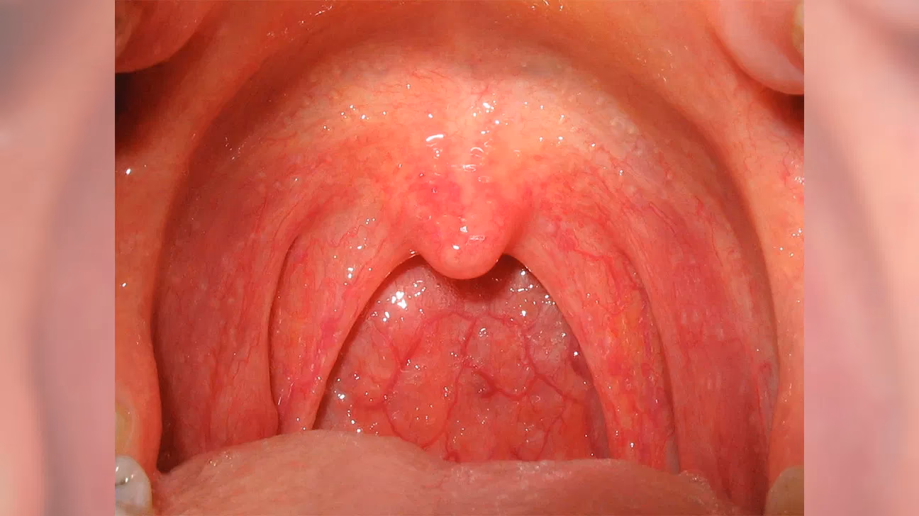 Why is my throat yellow for a fellow?