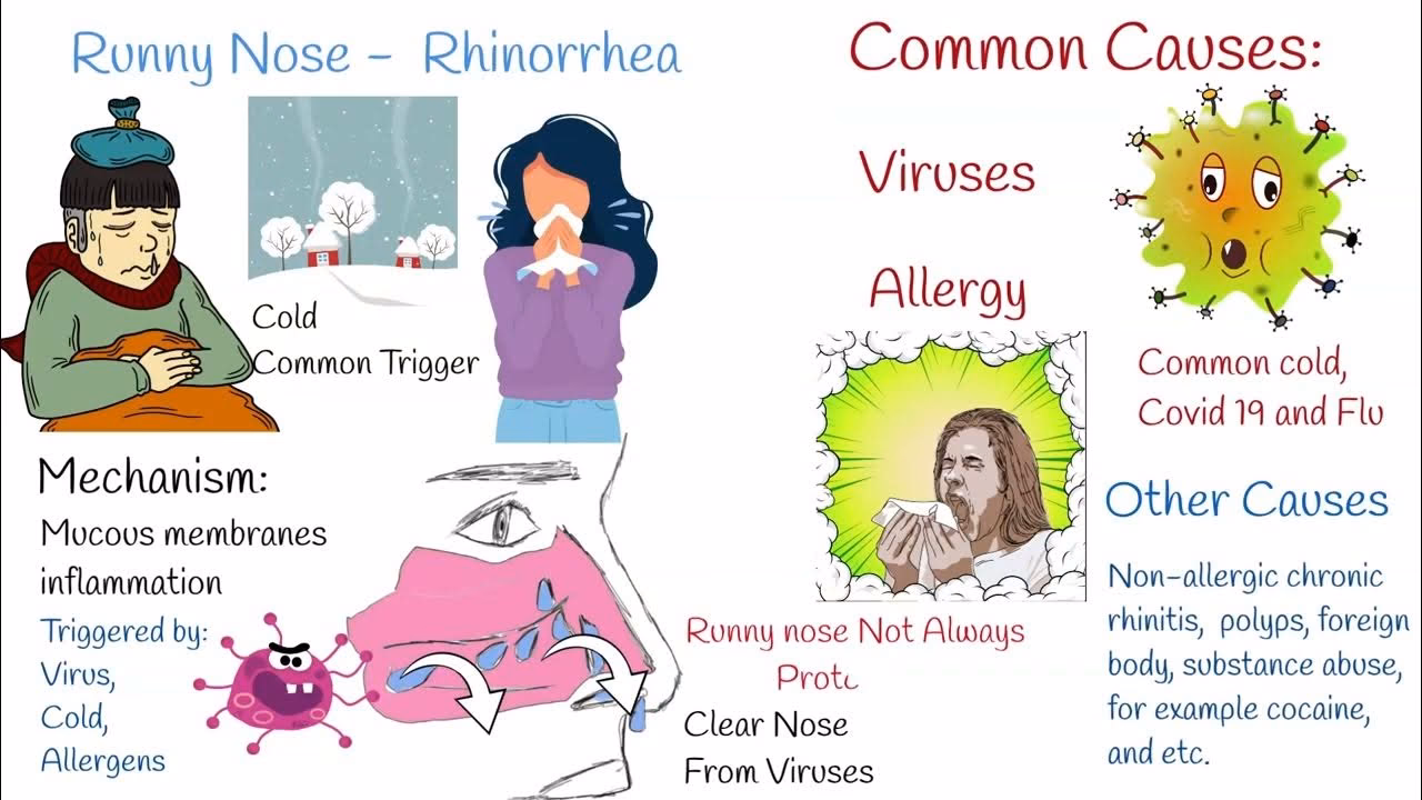 What causes vasomotor rhinitis?
