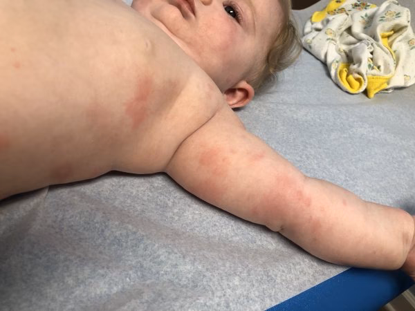 Can babies eat butternut squash?