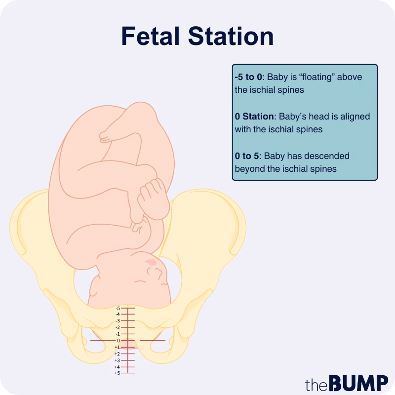 Why is fetal station important?