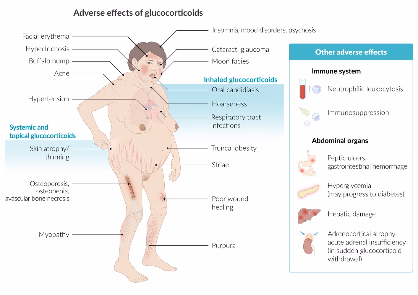 What are the short-term side effects of steroids?