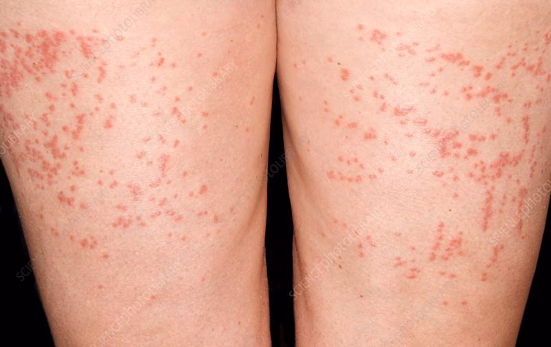 What are gluten based straws?