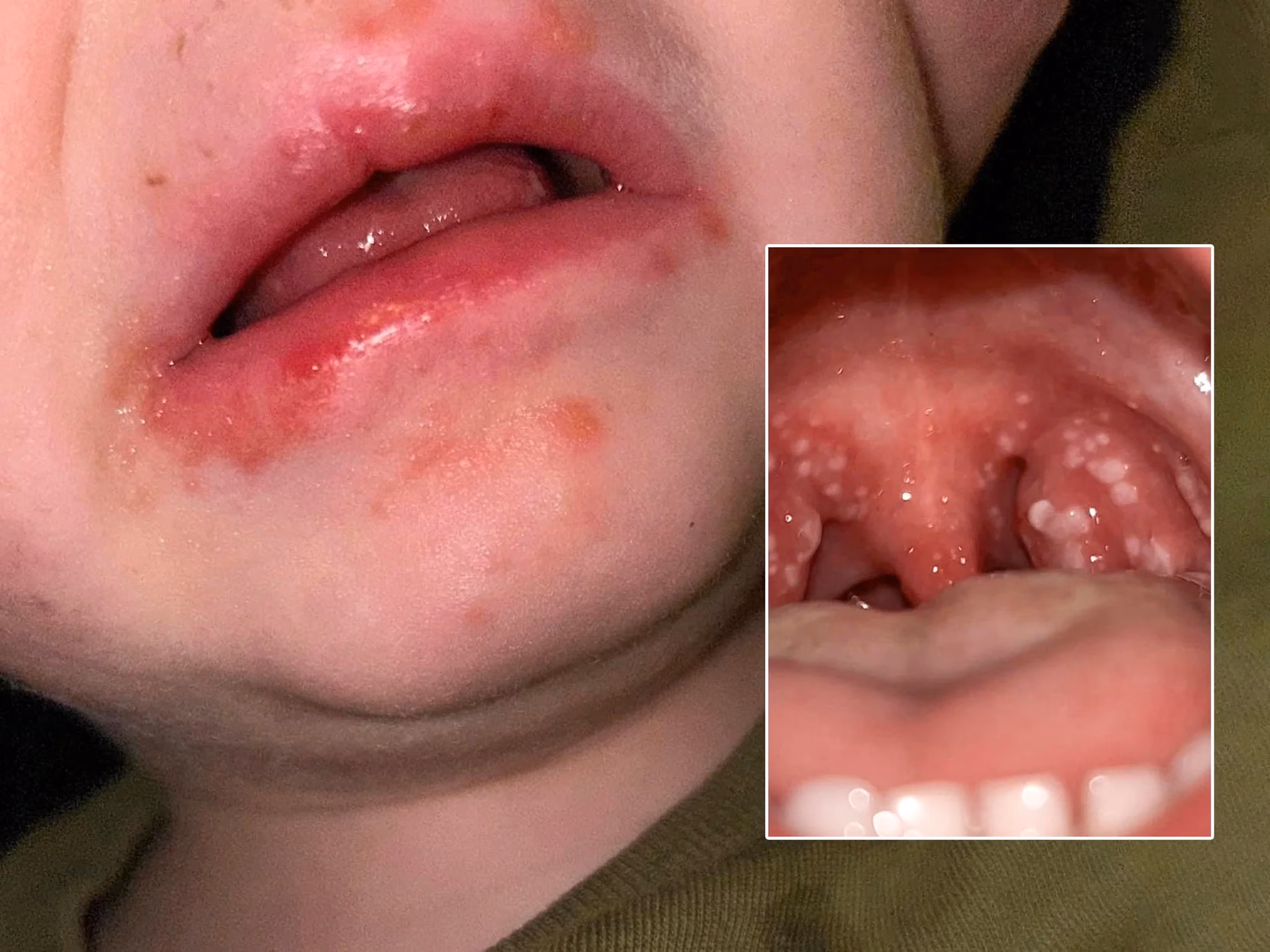 Can a child be tested for strep throat?