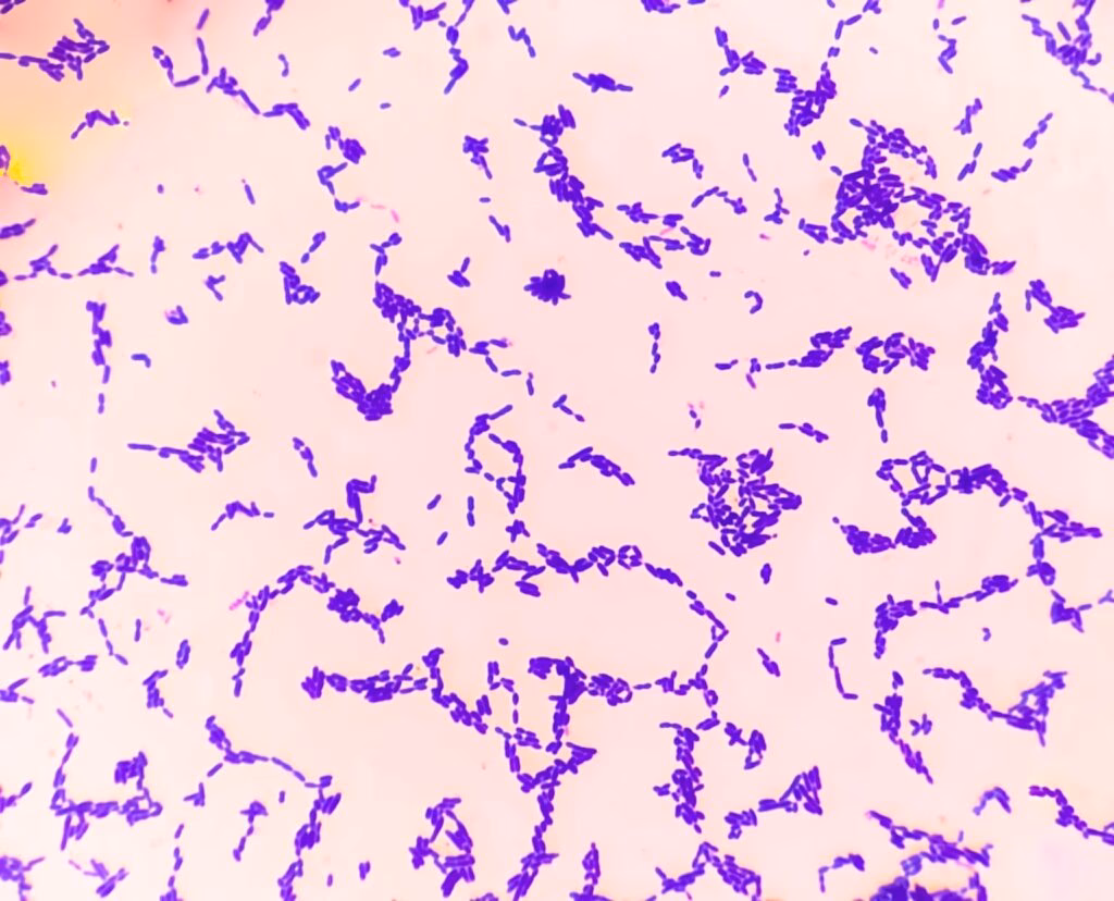 What is Streptococcus pneumoniae?