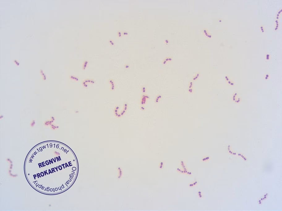 Is Streptococcus cristatus a member of the mitis group?