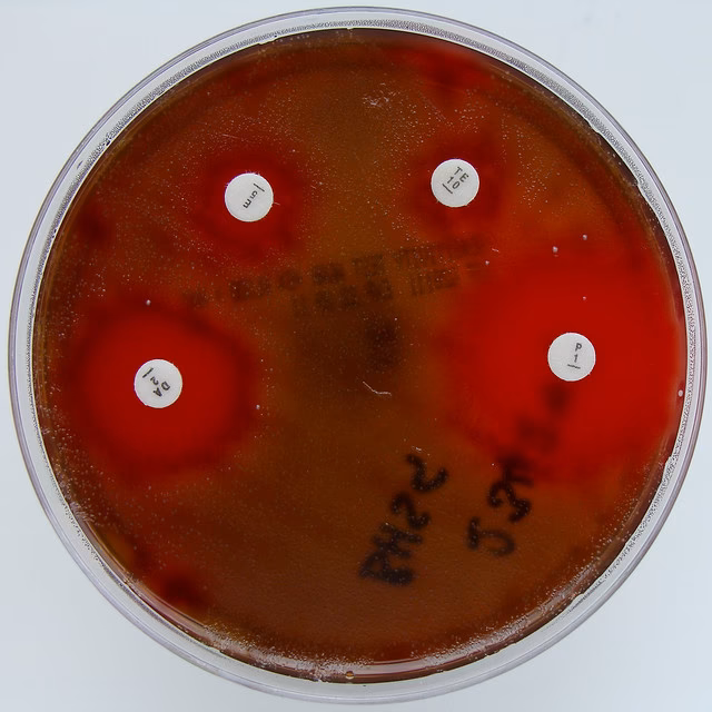 How do you test for clindamycin resistance in Streptococcus pneumoniae?