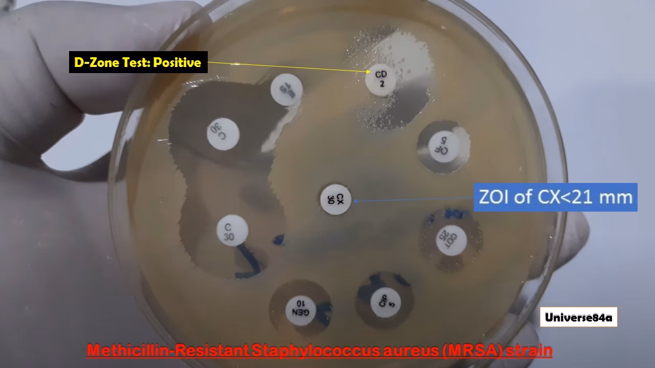 What is D test in Staphylococcus aureus?