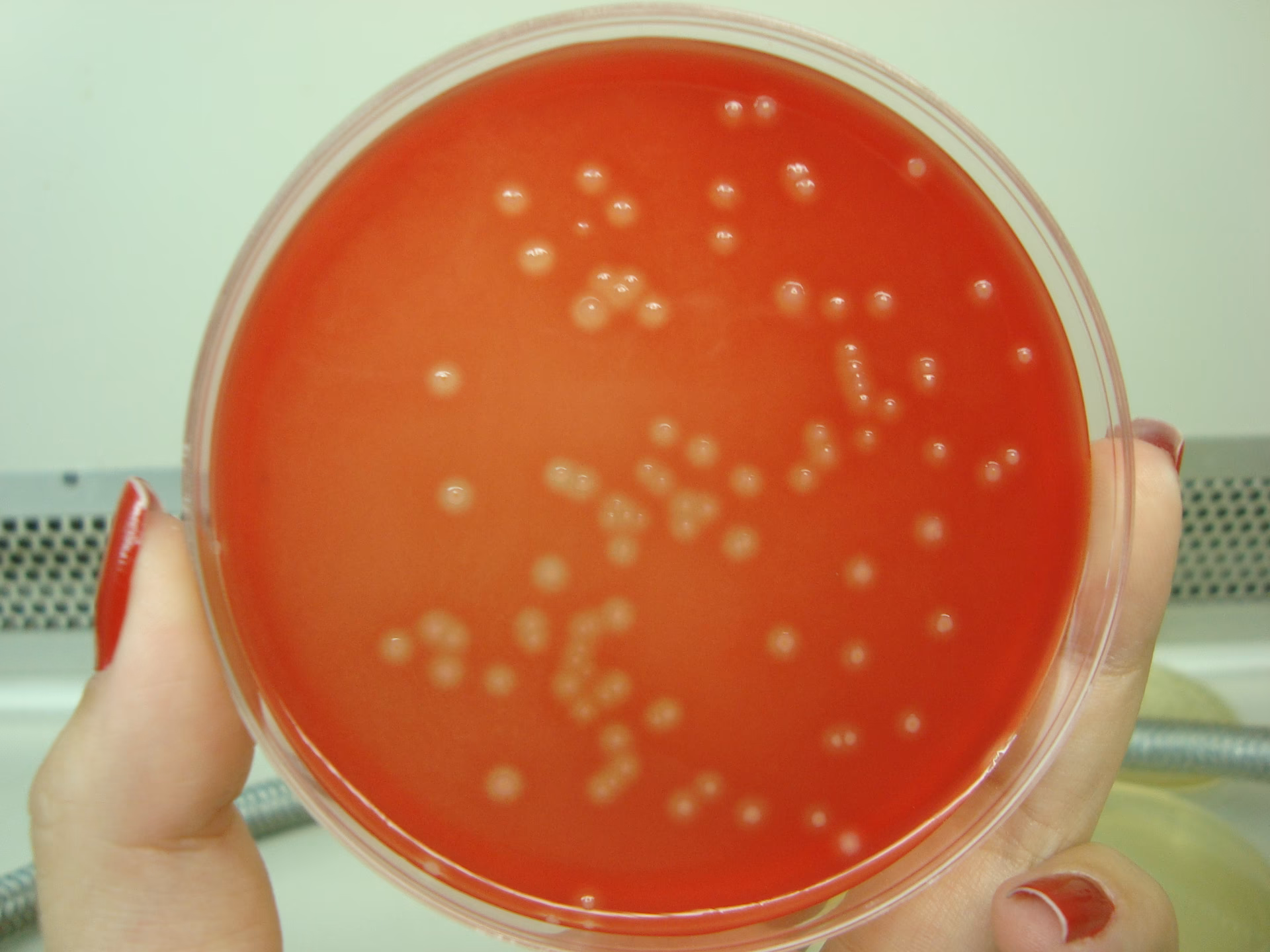 Quais são os representantes esféricos do gênero Streptococcus?