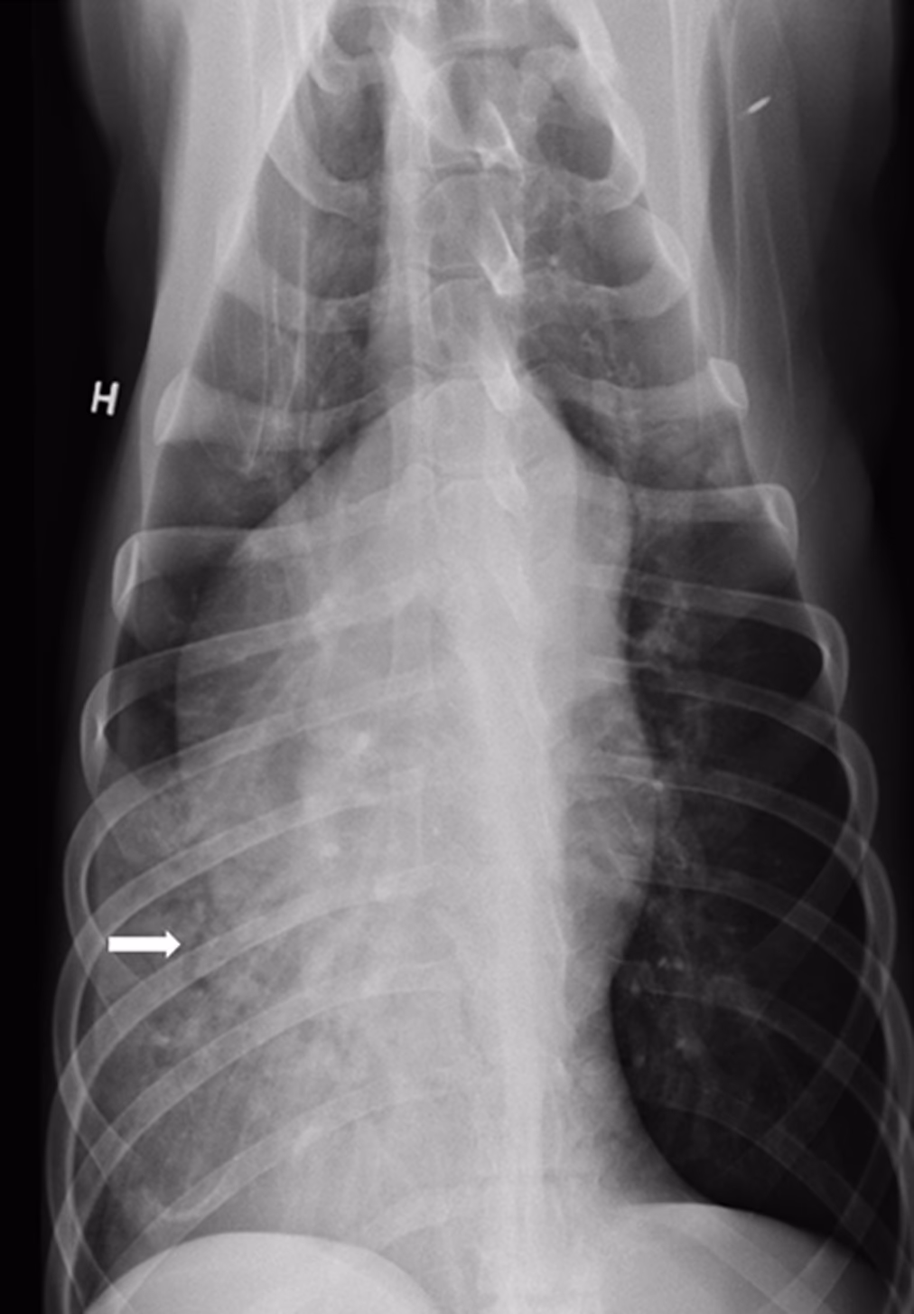 Can Streptococcus equi cause pneumonia?