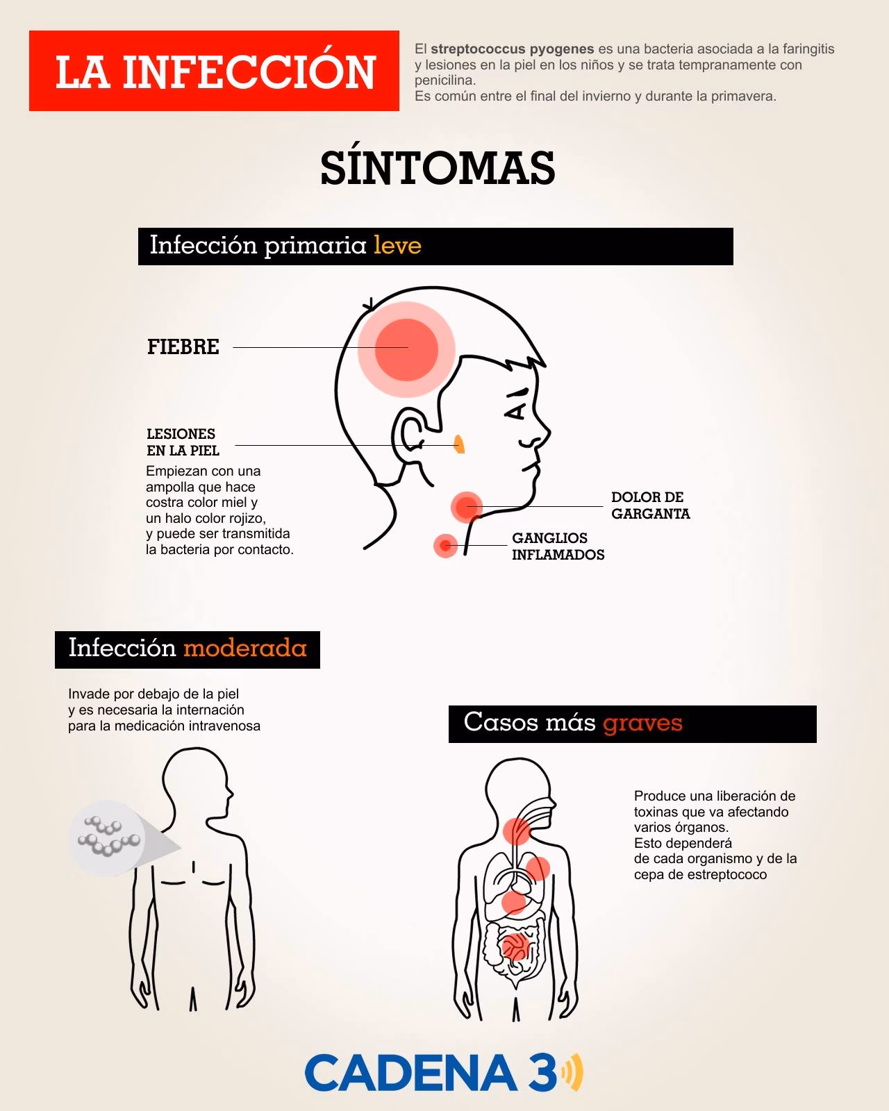 ¿Qué es el Streptococcus mitis?