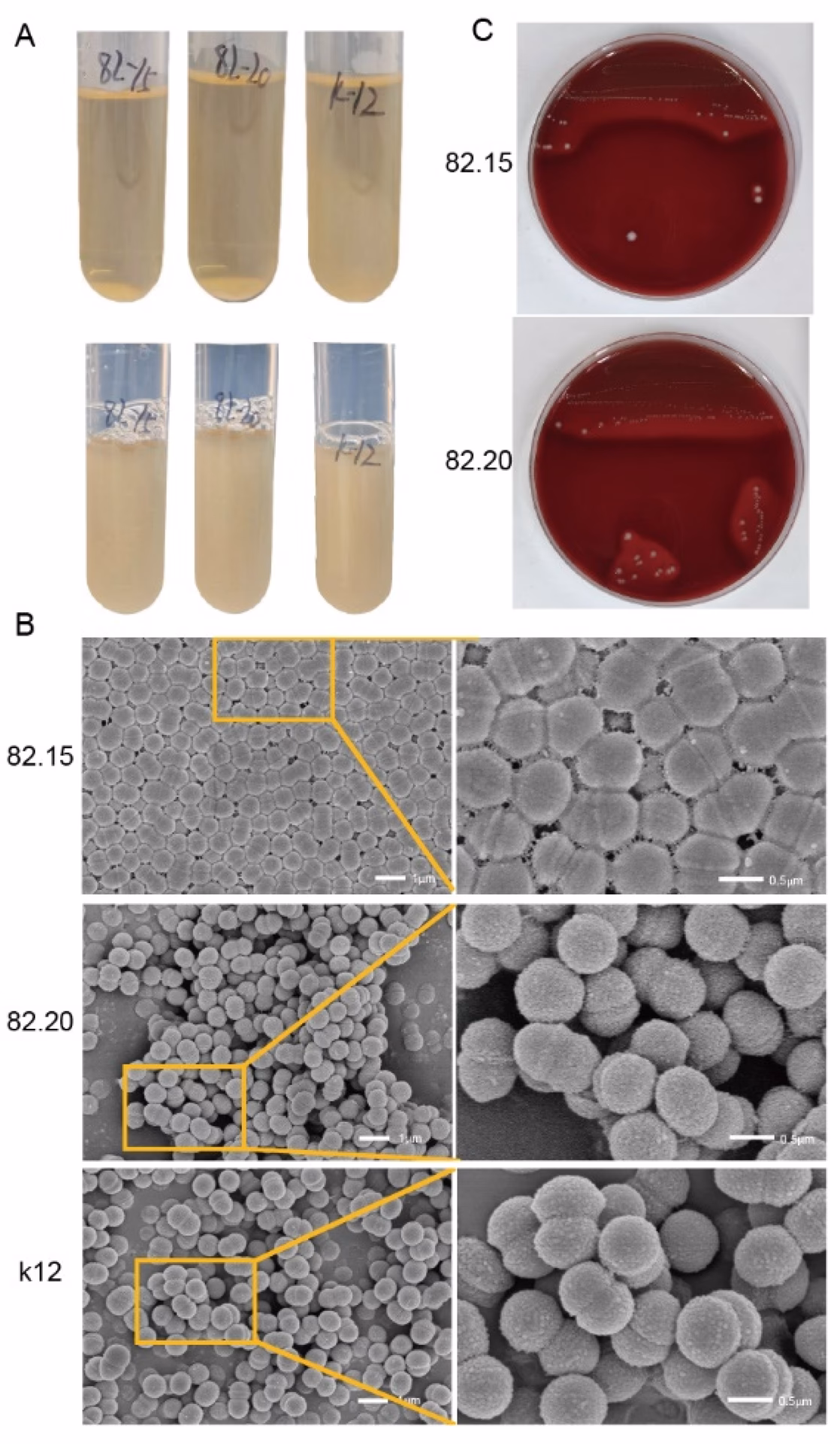 Which bacterium is similar to Streptococcus vestibularis?
