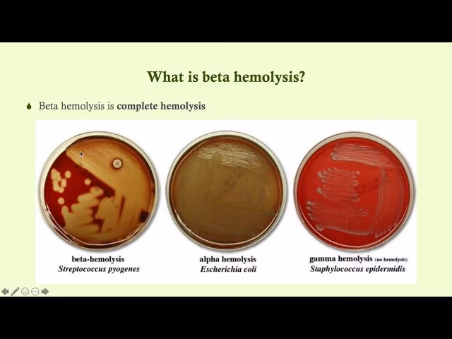 Are beta-hemolytic streptococci zoonotic?