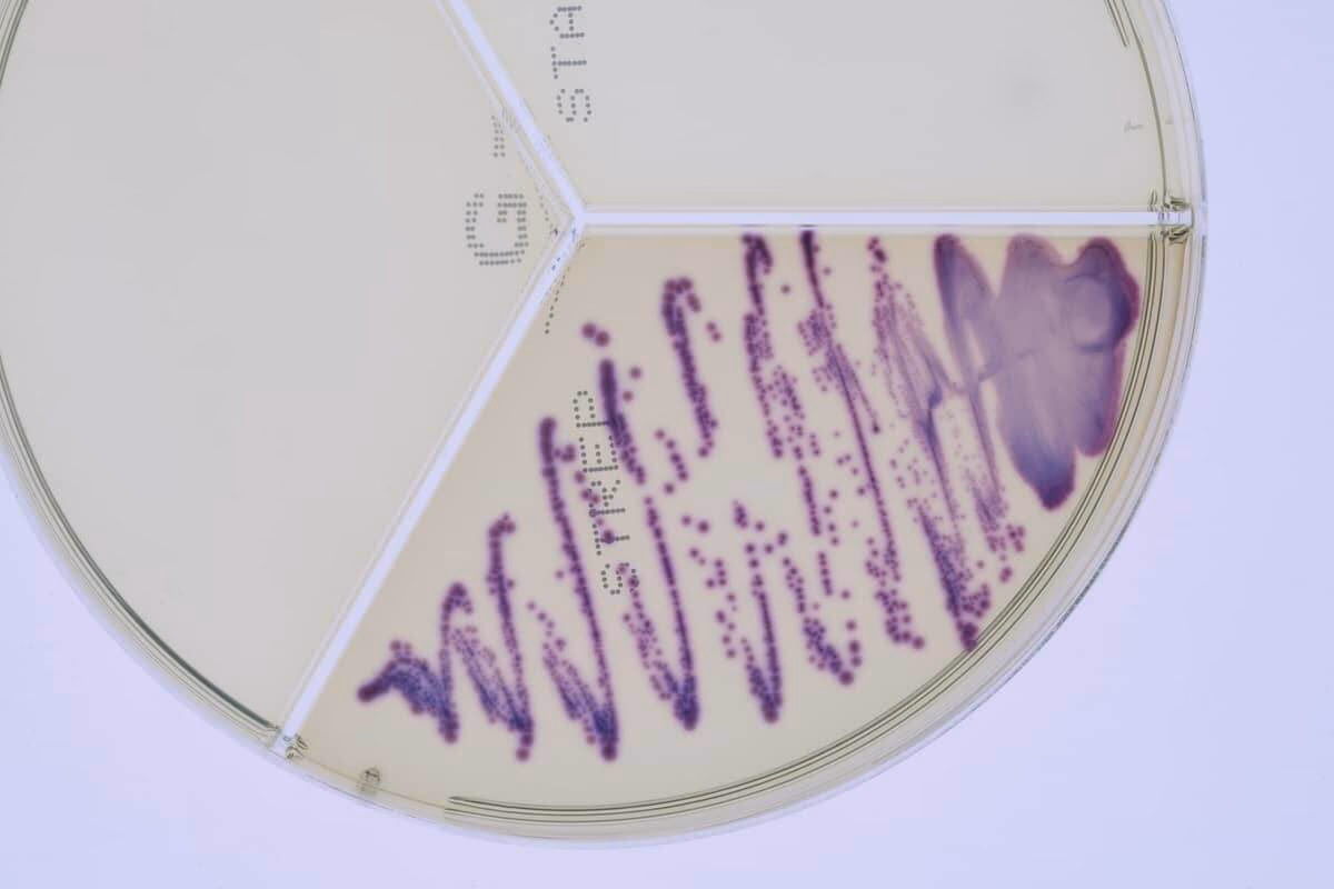 Do environmental streptococci cause mastitis?