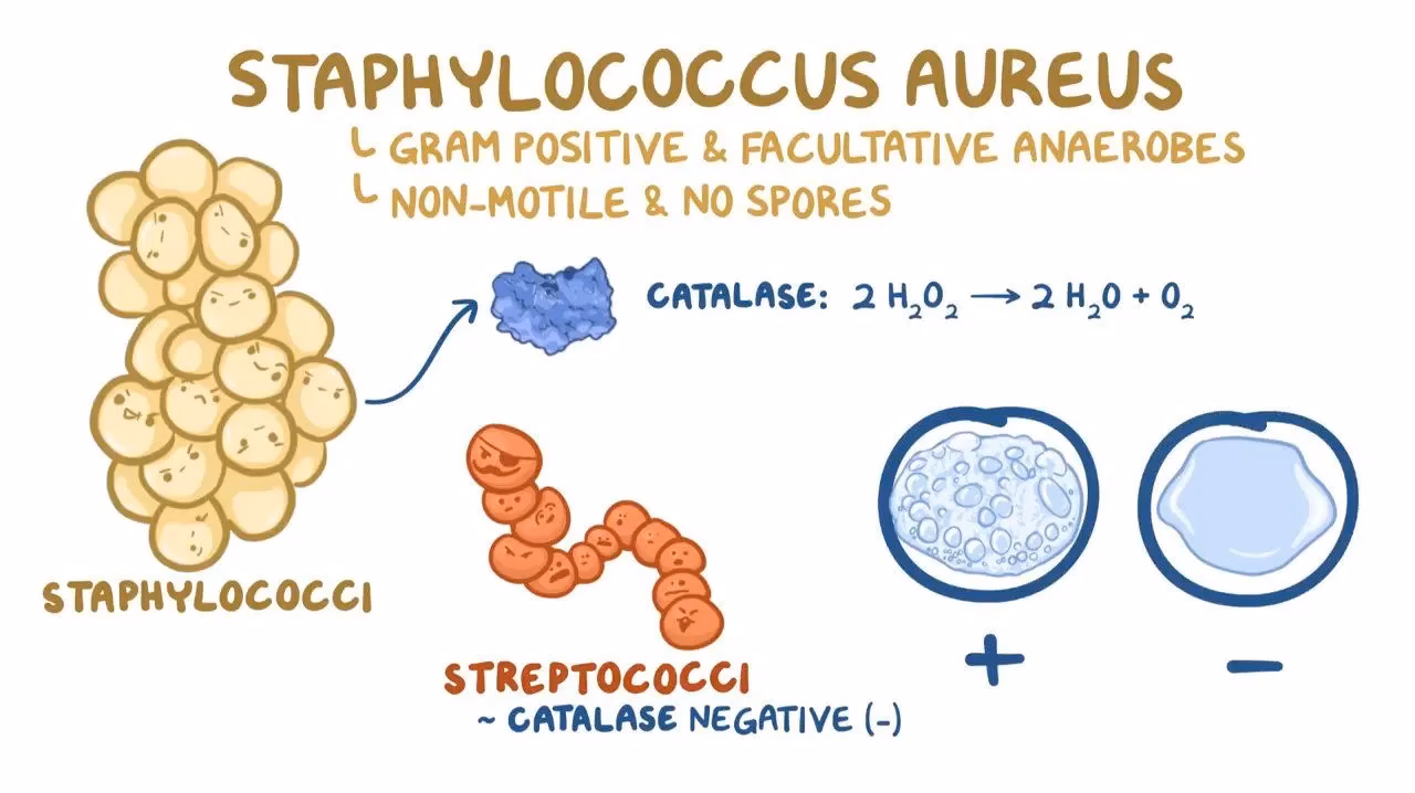 ¿Cómo se identifica el Streptococcus?