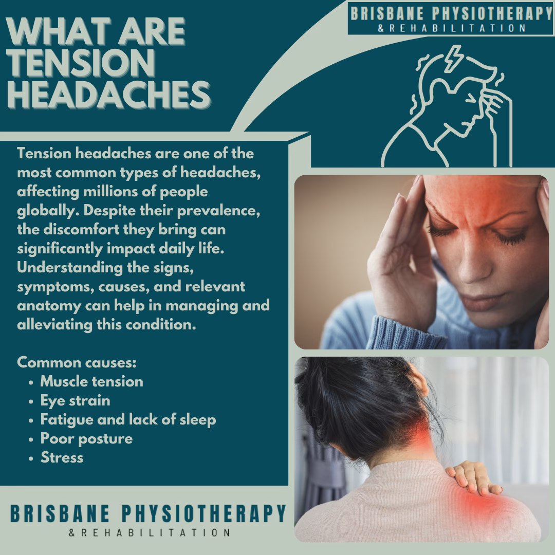 Can tension headaches cause nausea?