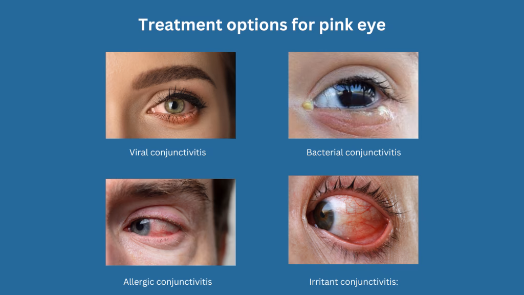 Can a tear duct be a symptom of allergies?