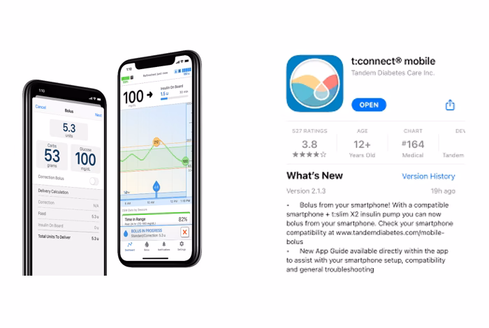 What is TConnect diabetes management?
