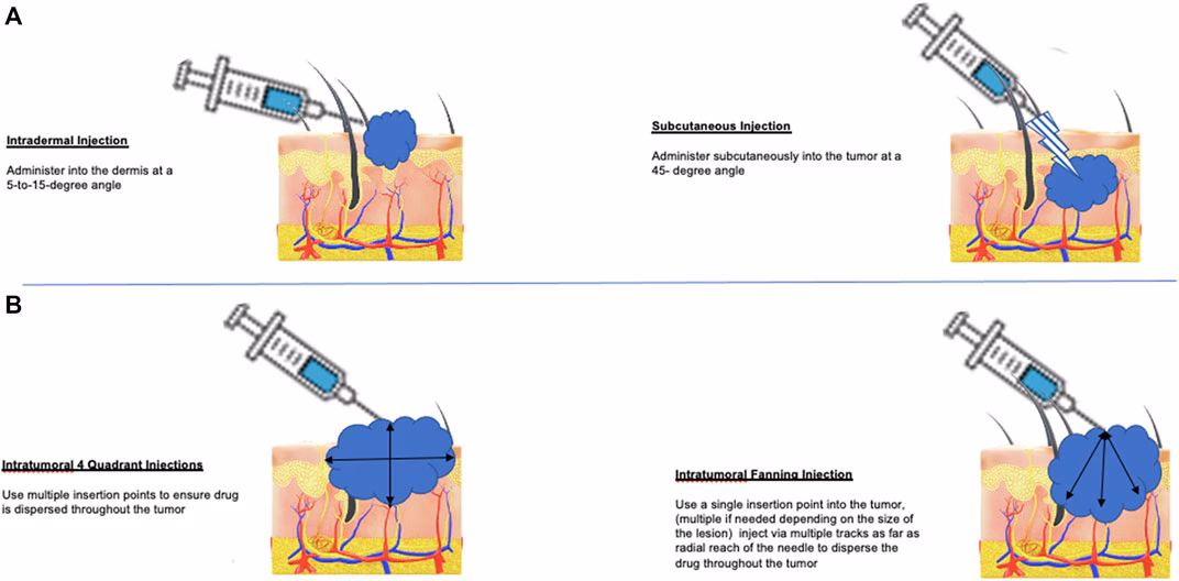 How does T-Vec work in melanoma?